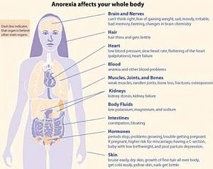     

:	Anorexia-Nervosa2.jpg‏
:	798
:	21.1 
:	20159