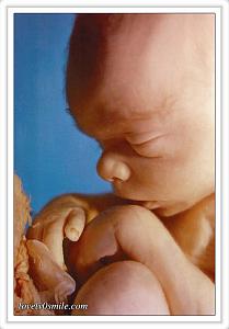     

:	fetus-10.jpg
:	718
:	64.4 
:	45376